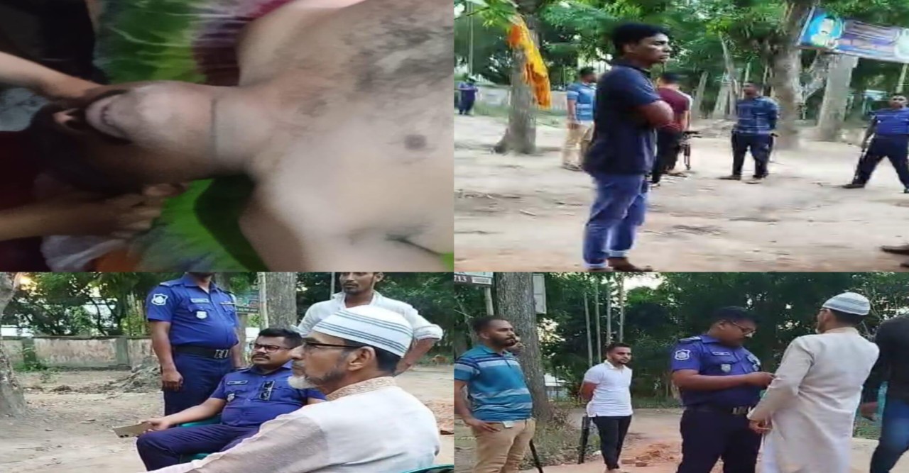 ব্রাহ্মণপাড়ায় চোর ধরিয়ে দেওয়ায় হামলার শিকার ওয়ার্ড মেম্বার, সাংবাদিকও আহত